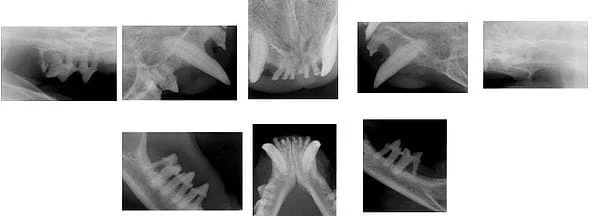 x-ray images of teeth