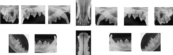 x-ray images of teeth